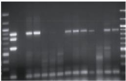 DNA-fingerprints of E. coli from various source materials
